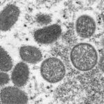 Renaming the Monkeypox Variants Curbs Stigma: Africa’s CDC