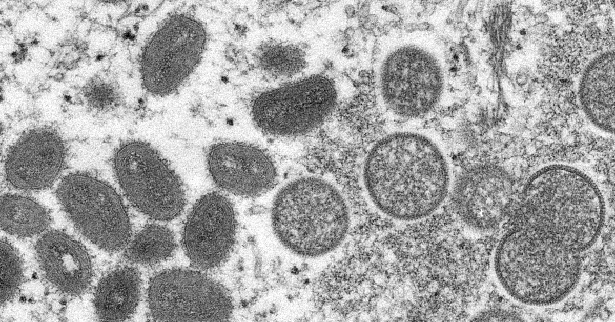 Renaming the Monkeypox Variants Curbs Stigma: Africa’s CDC