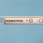 We’re Testing for Monkeypox the Wrong Way