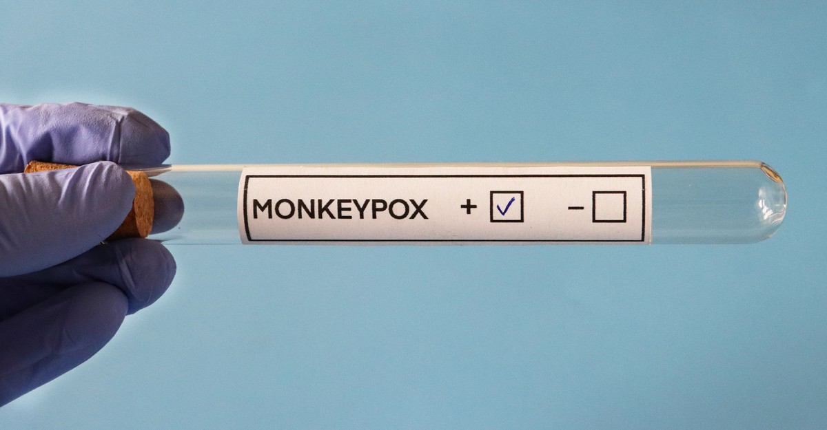 We’re Testing for Monkeypox the Wrong Way