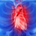 Coming to Terms With Heart Failure Coming to Terms With Heart Failure