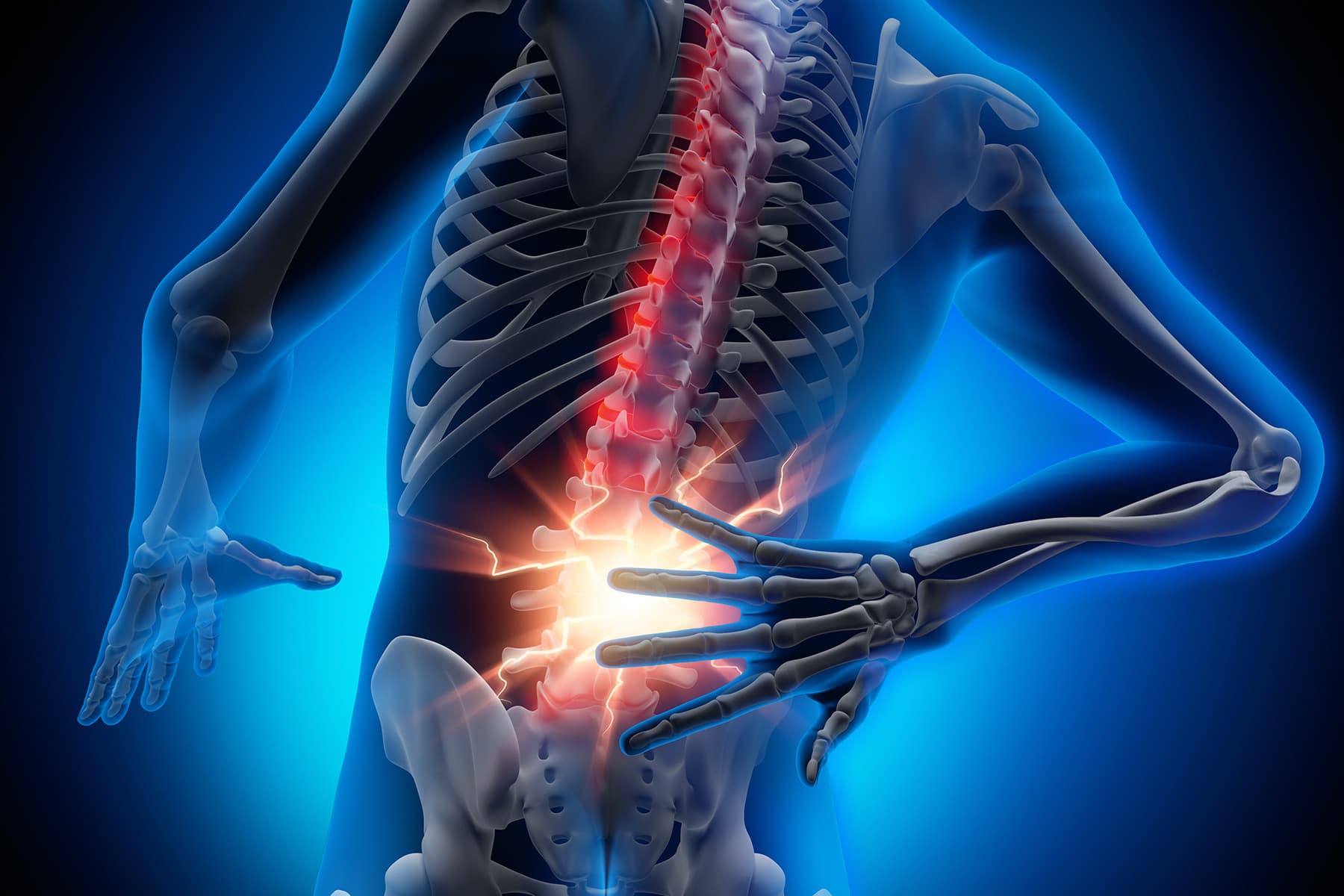 Non-Radiographic Axial Spondyloarthritis