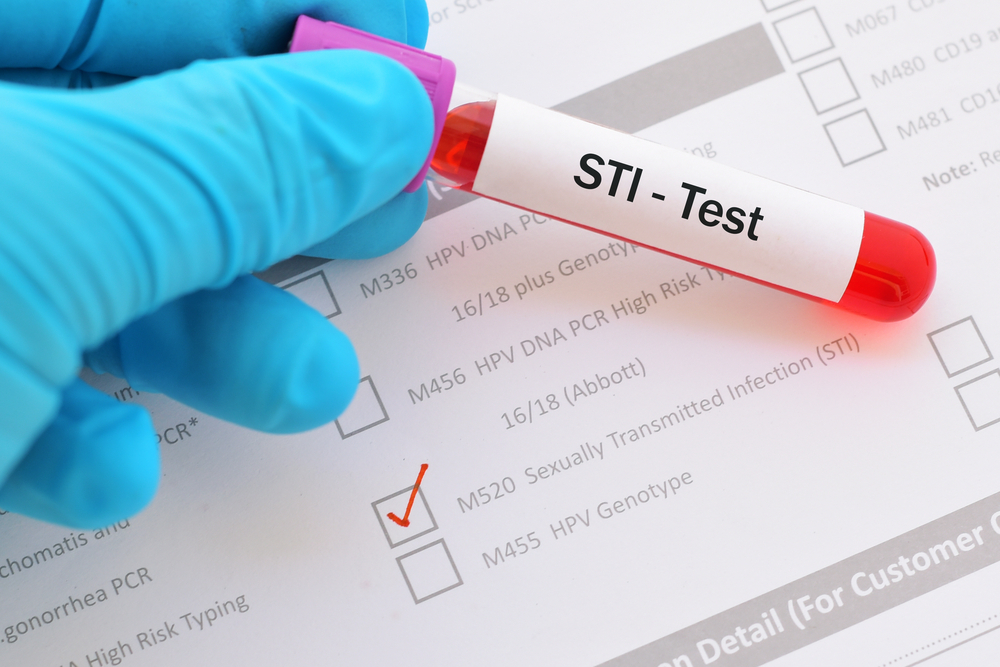 STIs: Get tested, get treated